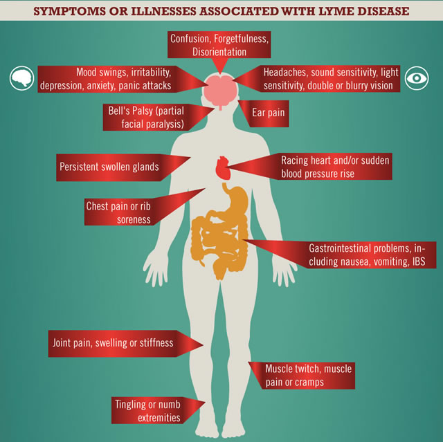 lyme-disease